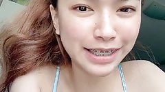 Gavins Thai teen with braces birthday message